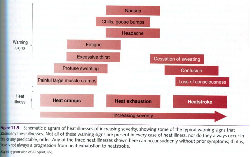 heat cramp symptoms